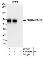 DNAM-1 Antibody in Immunoprecipitation (IP)