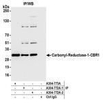 Carbonyl Reductase 1/CBR1 Antibody in Immunoprecipitation (IP)