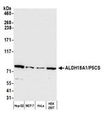 ALDH18A1/P5CS Antibody in Western Blot (WB)