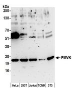 PMVK Antibody in Western Blot (WB)