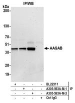 AAGAB Antibody in Immunoprecipitation (IP)