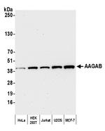 AAGAB Antibody in Western Blot (WB)