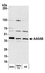 AAGAB Antibody in Western Blot (WB)