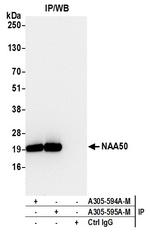 NAA50 Antibody in Immunoprecipitation (IP)