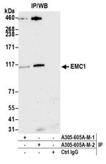 EMC1 Antibody in Immunoprecipitation (IP)