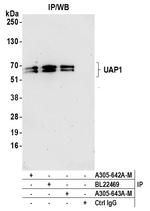 UAP1 Antibody in Immunoprecipitation (IP)