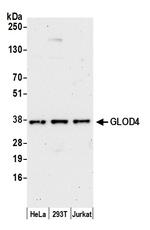 GLOD4 Antibody in Western Blot (WB)