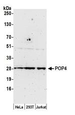 POP4 Antibody in Western Blot (WB)