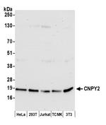 CNPY2 Antibody in Western Blot (WB)