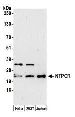 NTPCR Antibody in Western Blot (WB)