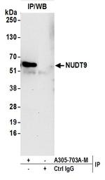 NUDT9 Antibody in Immunoprecipitation (IP)