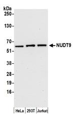 NUDT9 Antibody in Western Blot (WB)