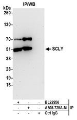 SCLY Antibody in Immunoprecipitation (IP)