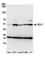 SCLY Antibody in Western Blot (WB)