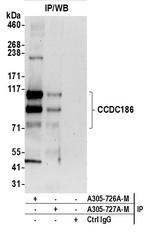 CCDC186 Antibody in Immunoprecipitation (IP)