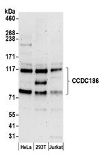 CCDC186 Antibody in Western Blot (WB)