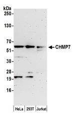 CHMP7 Antibody in Western Blot (WB)