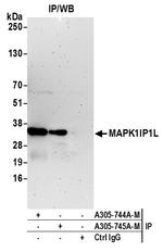 MAPK1IP1L Antibody in Immunoprecipitation (IP)