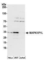 MAPK1IP1L Antibody in Western Blot (WB)