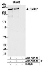 DMXL2 Antibody in Immunoprecipitation (IP)