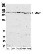 CNOT1 Antibody in Western Blot (WB)