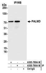 PALMD Antibody in Immunoprecipitation (IP)