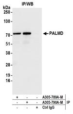 PALMD Antibody in Immunoprecipitation (IP)