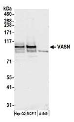 VASN Antibody in Western Blot (WB)