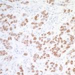 SOX10 Antibody in Immunohistochemistry (Paraffin) (IHC (P))