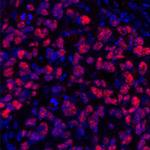 SOX10 Antibody in Immunohistochemistry (Paraffin) (IHC (P))