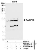 RanBP16 Antibody in Immunoprecipitation (IP)