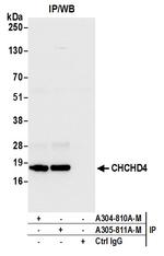 CHCHD4 Antibody in Immunoprecipitation (IP)