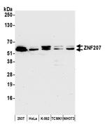 ZNF207 Antibody in Western Blot (WB)