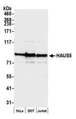 HAUS5 Antibody in Western Blot (WB)