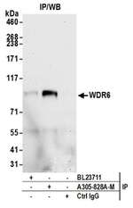 WDR6 Antibody in Immunoprecipitation (IP)