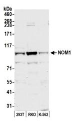 NOM1 Antibody in Western Blot (WB)