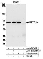 METTL14 Antibody in Immunoprecipitation (IP)