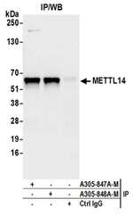 METTL14 Antibody in Immunoprecipitation (IP)