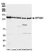 EFTUD1 Antibody in Western Blot (WB)