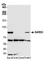 SARDH Antibody in Western Blot (WB)