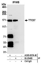 TTC37 Antibody in Immunoprecipitation (IP)