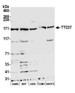 TTC37 Antibody in Western Blot (WB)