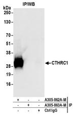 CTHRC1 Antibody in Immunoprecipitation (IP)
