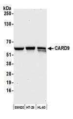 CARD9 Antibody in Western Blot (WB)