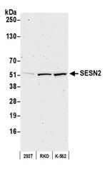 SESN2 Antibody in Western Blot (WB)