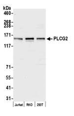 PLCG2 Antibody in Western Blot (WB)