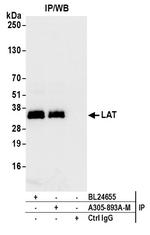 LAT Antibody in Immunoprecipitation (IP)