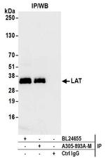 LAT Antibody in Immunoprecipitation (IP)