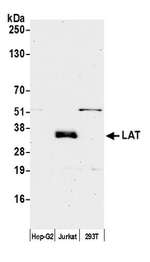 LAT Antibody in Western Blot (WB)