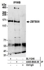 ZBTB38 Antibody in Immunoprecipitation (IP)